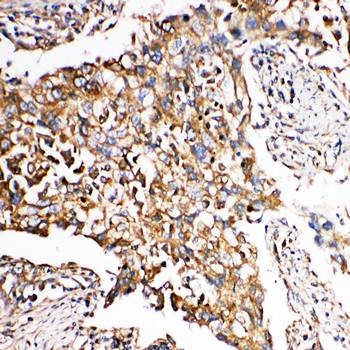 SMAD5 Rabbit Polyclonal Antibody
