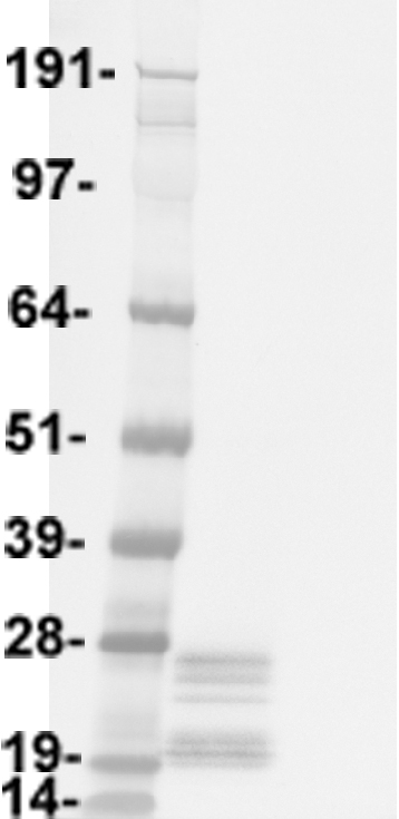 Corticotropin Releasing Factor (CRH) Human Over-expression Lysate