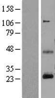CD3E Human Over-expression Lysate