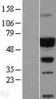 CACNB4 Human Over-expression Lysate