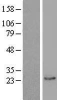 BLVRB Human Over-expression Lysate
