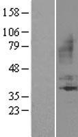 BDKRB1 Human Over-expression Lysate