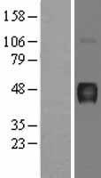 ATP4B Human Over-expression Lysate
