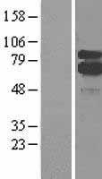 5 Lipoxygenase (ALOX5) Human Over-expression Lysate