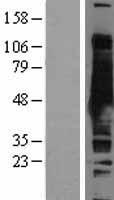 S adenosylhomocysteine hydrolase (AHCY) Human Over-expression Lysate