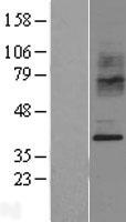 CCR2 Human Over-expression Lysate