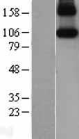 iNOS (NOS2) Human Over-expression Lysate