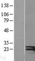 Interferon gamma (IFNG) Human Over-expression Lysate