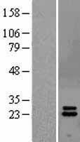 Interferon alpha 2 (IFNA2) Human Over-expression Lysate