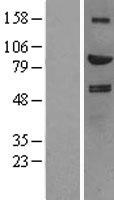 HGF Human Over-expression Lysate