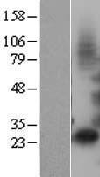 IGFBP1 Human Over-expression Lysate