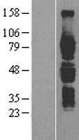 IL6R Human Over-expression Lysate