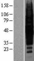 Rhodopsin (RHO) Human Over-expression Lysate