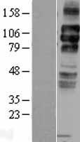 LDL Receptor (LDLR) Human Over-expression Lysate