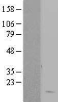 Hemoglobin subunit delta (HBD) Human Over-expression Lysate