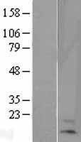 HBA-T2 (HBB) Human Over-expression Lysate