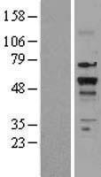 Thyroid Hormone Receptor beta (THRB) Human Over-expression Lysate