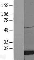Superoxide Dismutase 1 (SOD1) Human Over-expression Lysate