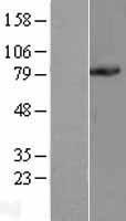 PC1/3 (PCSK1) Human Over-expression Lysate