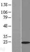 Myosin Light Chain 2 (MYL2) Human Over-expression Lysate