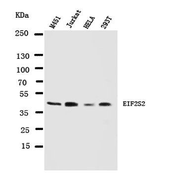 EIF2S2 Rabbit Polyclonal Antibody