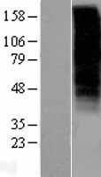 GNRHR Human Over-expression Lysate