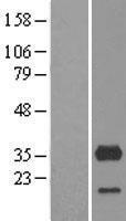 CYB5R3 Human Over-expression Lysate