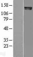 Xanthine Oxidase (XDH) Human Over-expression Lysate