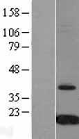 Prealbumin (TTR) Human Over-expression Lysate