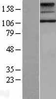 TSH Receptor (TSHR) Human Over-expression Lysate