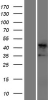 Cardiac Troponin T (TNNT2) Human Over-expression Lysate