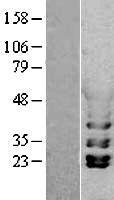 PGK1 Human Over-expression Lysate