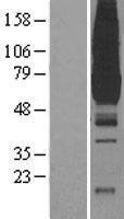 Pyruvate Kinase (PKLR) Human Over-expression Lysate