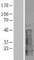 NM23A (NME1) Human Over-expression Lysate