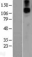 Jagged1 (JAG1) Human Over-expression Lysate