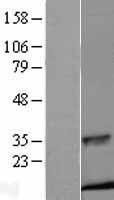 Insulin (INS) Human Over-expression Lysate