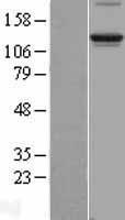 Integrin alpha 6 (ITGA6) Human Over-expression Lysate