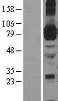 ICAM1 Human Over-expression Lysate