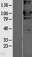 Hexokinase II (HK2) Human Over-expression Lysate