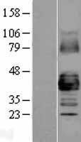 GJA1 Human Over-expression Lysate