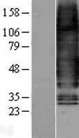 Glucagon Receptor (GCGR) Human Over-expression Lysate