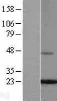 Ferritin Light Chain (FTL) Human Over-expression Lysate