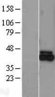 FECH Human Over-expression Lysate