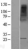 MS4A2 Human Over-expression Lysate