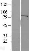 Factor XIIIa (F13A1) Human Over-expression Lysate