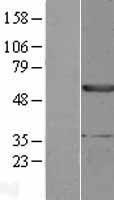 Epoxide hydrolase (EPHX1) Human Over-expression Lysate