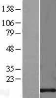 Cystatin C (CST3) Human Over-expression Lysate