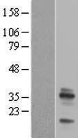 Emerin (EMD) Human Over-expression Lysate