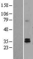 TAZ Human Over-expression Lysate