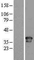 Torsin A (TOR1A) Human Over-expression Lysate